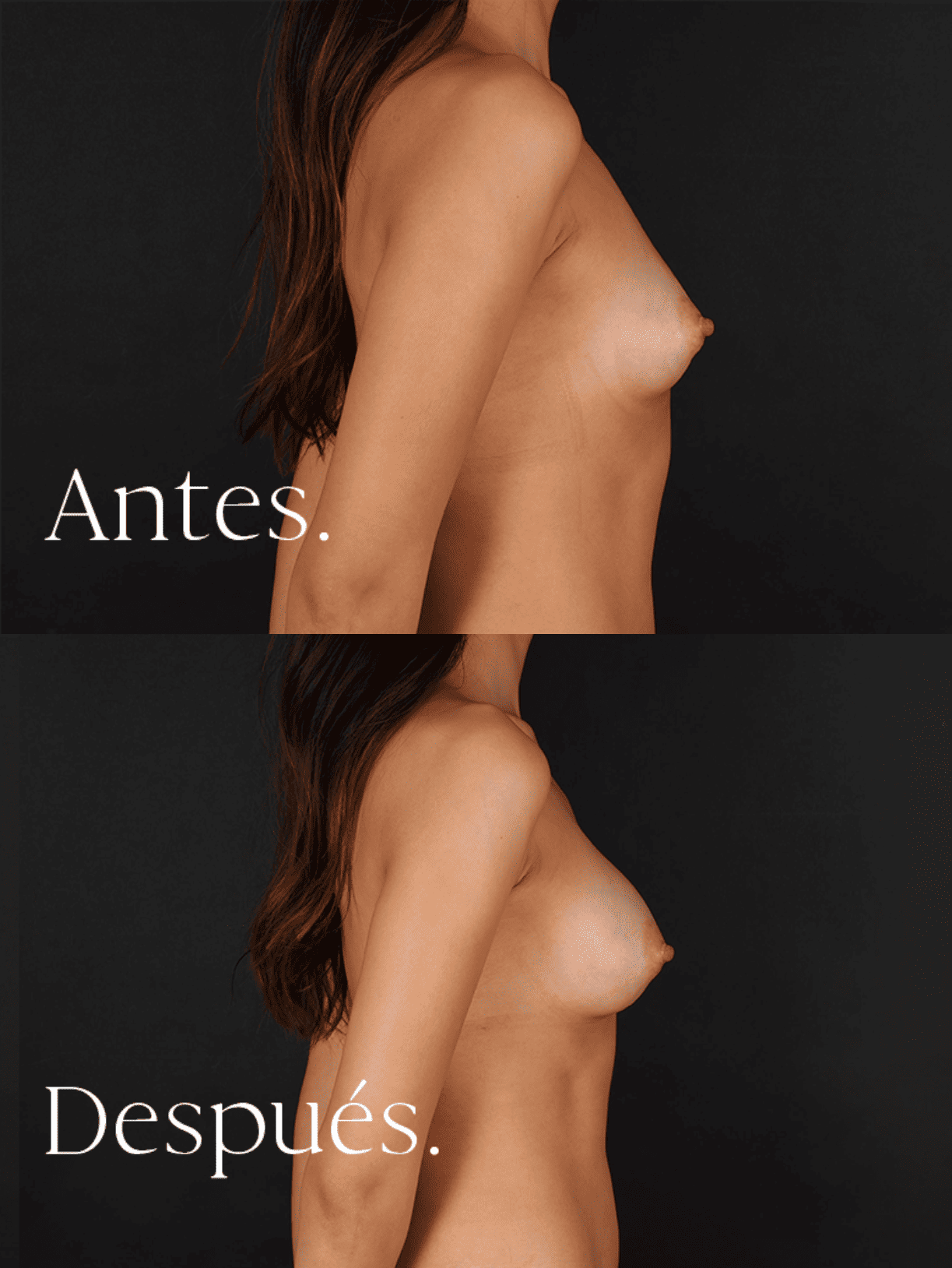 antes-y-despues