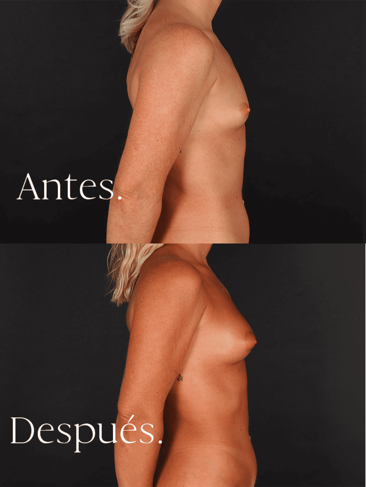 antes-y-despues