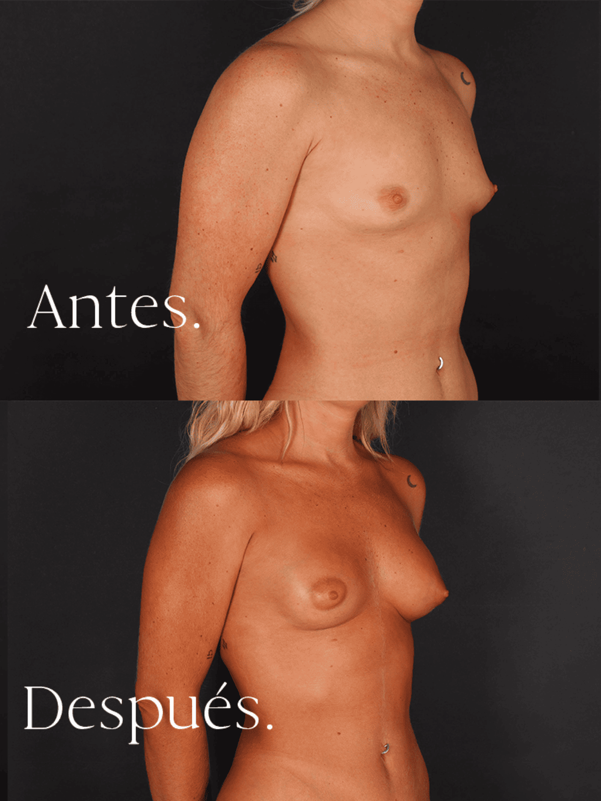 antes-y-despues